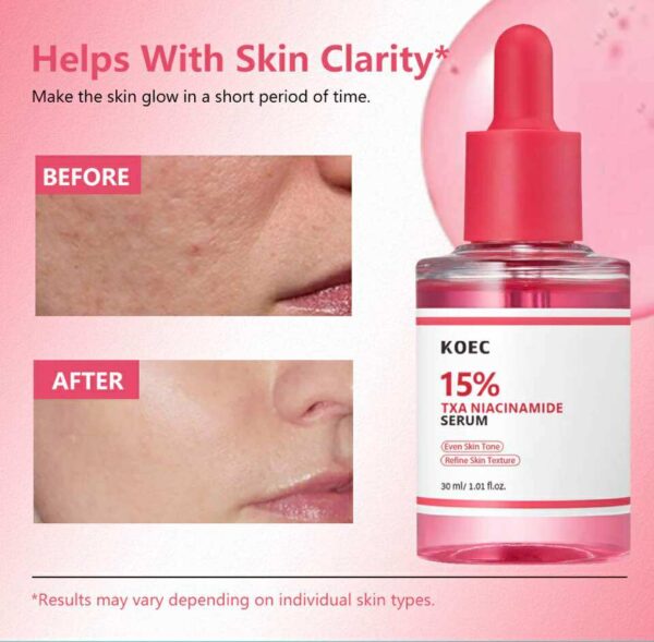 15% TXA niacinamide serum