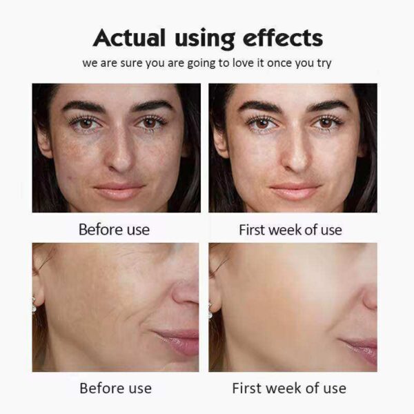 20% Vitamin C Ampoules Serum