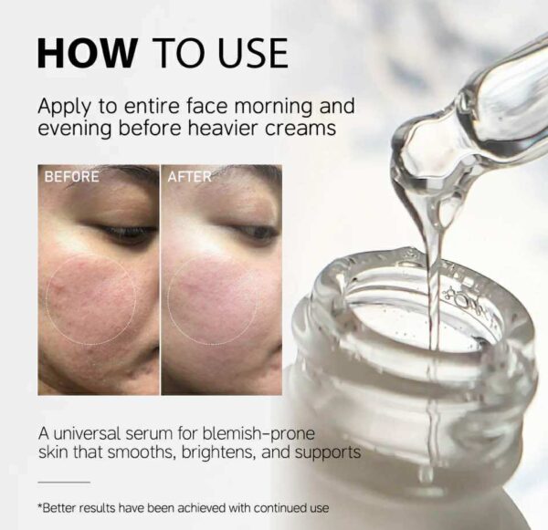 Niacinamide 10%+zinc 1% face serum